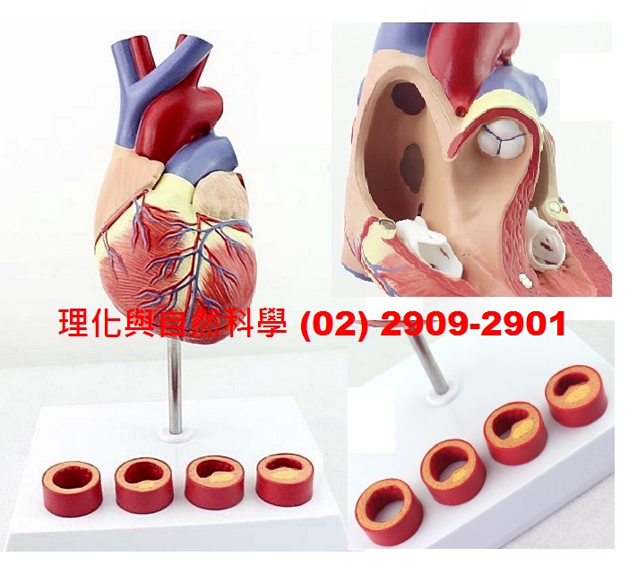 【心臟】模型 1:1 四階段-血栓形成 2分解